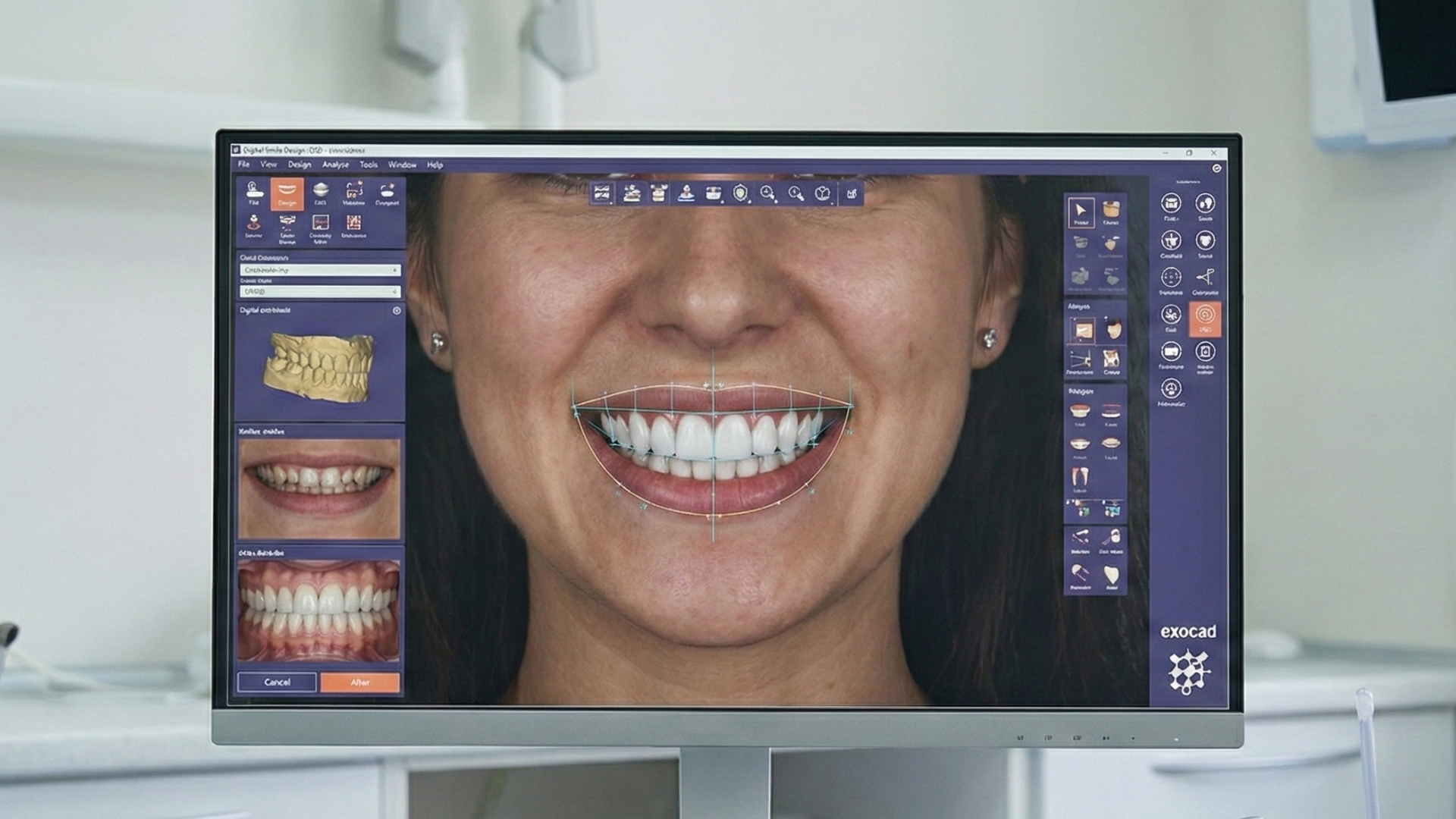 clínica dental en montenquinto