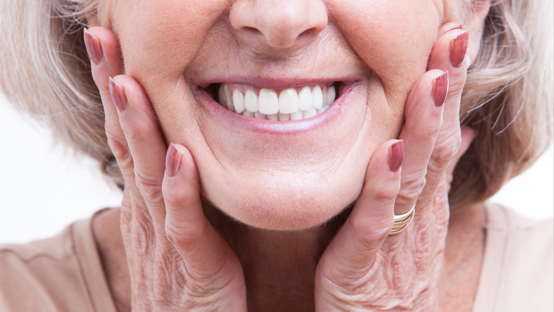 Dientes en 1 día: qué es la prótesis inmediata y para quién